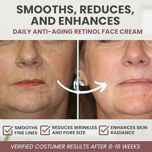 Before and after results of anti-aging retinol face cream application.