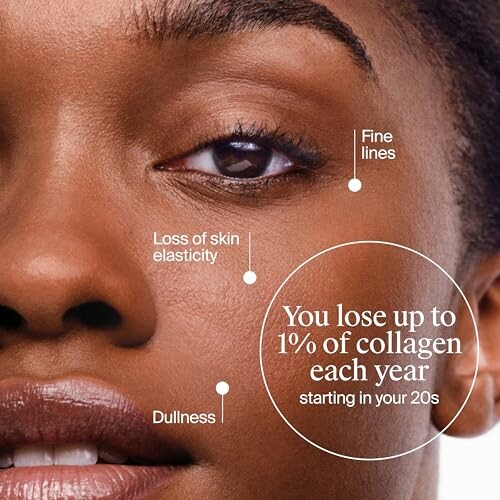 Woman's face showing skin aging effects.