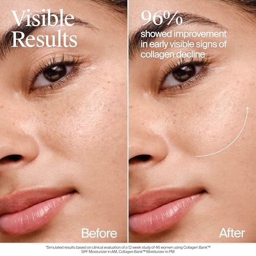 Woman's face showing skincare results with before and after comparison.